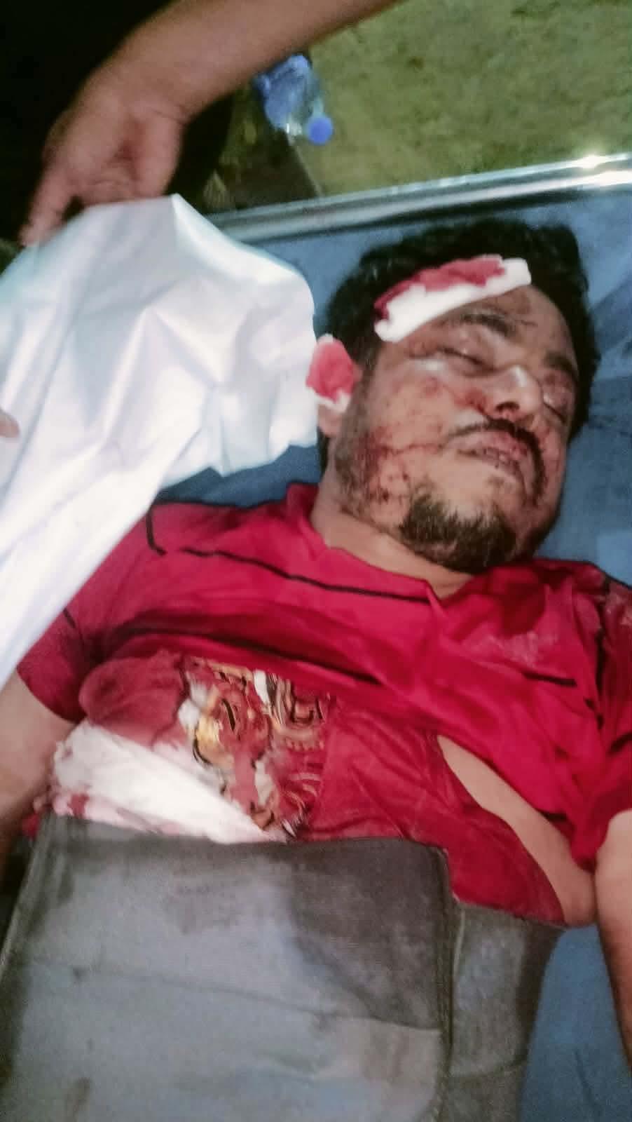 সন্ত্রাসীদের গুলিতে রোহিঙ্গা সন্ত্রাসী আব্দুল হালিম নিহত, আহত ২